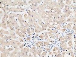 Invitrogen RBP4 Polyclonal Antibody 100 &mu;L; Unconjugated:Antibodies,