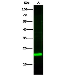 Invitrogen RBP4 Polyclonal Antibody 100 &mu;L; Unconjugated:Antibodies,