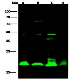 Invitrogen Cyclophilin B Polyclonal Antibody 100 &mu;L | Buy Online | Invitrogen&trade; | Fisher Scientific