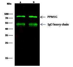 Invitrogen PPM1G Polyclonal Antibody 100 &mu;L | Buy Online | Invitrogen&trade; | Fisher Scientific