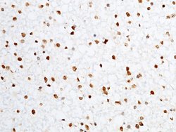 Invitrogen PRDM2 Polyclonal Antibody 100 &mu;L; Unconjugated:Antibodies,