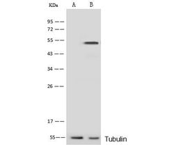 Invitrogen PRKAR1A Polyclonal Antibody 100 &mu;L; Unconjugated:Antibodies,