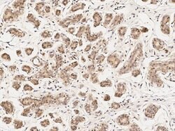 Invitrogen PKC delta Polyclonal Antibody 100 &mu;L; Unconjugated:Antibodies,