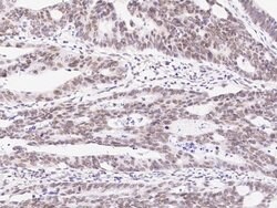 Invitrogen PRMT6 Polyclonal Antibody 100 &mu;L; Unconjugated:Antibodies,