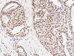 Invitrogen PRMT6 Polyclonal Antibody 100 &mu;L; Unconjugated:Antibodies,