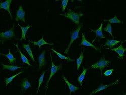 Invitrogen&trade;&nbsp;CAP1 Polyclonal Antibody