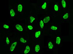PSME3 Polyclonal Antibody:Antibodies, Polyclonal