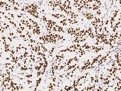 PSME3 Polyclonal Antibody:Antibodies, Polyclonal