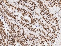 PSME3 Polyclonal Antibody:Antibodies, Polyclonal