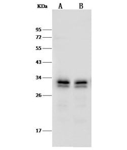 PSME3 Polyclonal Antibody:Antibodies, Polyclonal