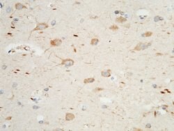 PTH1R Polyclonal Antibody:Antibodies, Polyclonal
