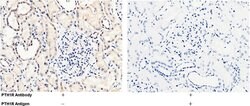 PTH1R Polyclonal Antibody:Antibodies, Polyclonal