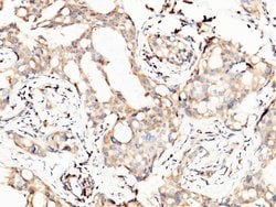 PTH1R Polyclonal Antibody:Antibodies, Polyclonal