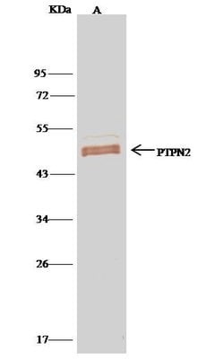 Invitrogen PTPN2 Polyclonal Antibody 100 &mu;L; Unconjugated:Antibodies,