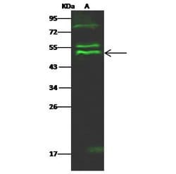 Invitrogen PTPN2 Polyclonal Antibody 100 &mu;L; Unconjugated:Antibodies,