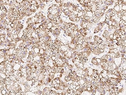 Invitrogen RACK1 Polyclonal Antibody 100 &mu;L | Buy Online | Invitrogen&trade; | Fisher Scientific