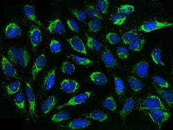 Invitrogen RBKS Polyclonal Antibody 100 &mu;L; Unconjugated:Antibodies,