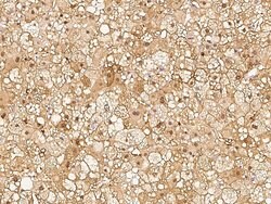 Invitrogen RBKS Polyclonal Antibody 100 &mu;L; Unconjugated:Antibodies,