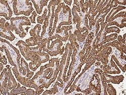 Invitrogen RhoBTB2 Polyclonal Antibody 100 &mu;L; Unconjugated:Antibodies,