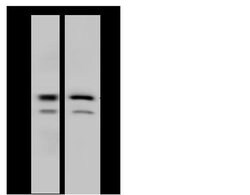 RNaseH2B Rabbit anti-Human, Polyclonal, Invitrogen 100 &mu;L; Unconjugated:Antibodies,