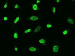 Invitrogen RNF14 Polyclonal Antibody 100 &mu;L; Unconjugated:Antibodies,