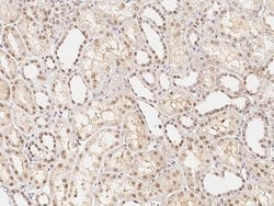 Invitrogen RNF14 Polyclonal Antibody 100 &mu;L; Unconjugated:Antibodies,