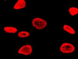 RSK3 Polyclonal Antibody:Antibodies, Polyclonal