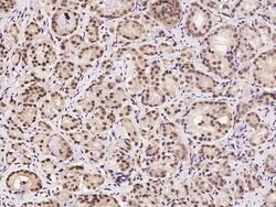 RSK3 Polyclonal Antibody:Antibodies, Polyclonal