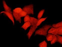 Invitrogen p70 S6 Kinase Polyclonal Antibody 100 &mu;L; Unconjugated:Antibodies,