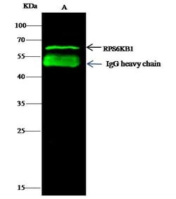 Invitrogen p70 S6 Kinase Polyclonal Antibody 100 &mu;L; Unconjugated:Antibodies,