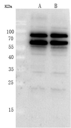 Invitrogen p70 S6 Kinase Polyclonal Antibody 100 &mu;L; Unconjugated:Antibodies,