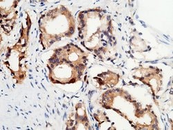 Invitrogen p53R2 Polyclonal Antibody 100 &mu;L; Unconjugated:Antibodies,