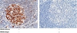Invitrogen p53R2 Polyclonal Antibody 100 &mu;L; Unconjugated:Antibodies,