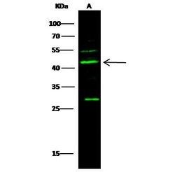 Invitrogen p53R2 Polyclonal Antibody 100 &mu;L; Unconjugated:Antibodies,