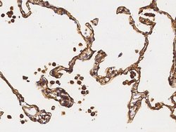 Invitrogen S100A10 Polyclonal Antibody 100 &mu;L; Unconjugated:Antibodies,