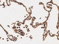 Invitrogen S100A10 Polyclonal Antibody 100 &mu;L; Unconjugated:Antibodies,