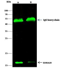 Invitrogen S100A10 Polyclonal Antibody 100 &mu;L; Unconjugated:Antibodies,