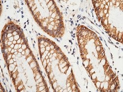 Invitrogen S100A16 Polyclonal Antibody 100 &mu;L; Unconjugated:Antibodies,