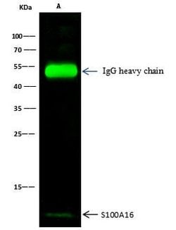 Invitrogen S100A16 Polyclonal Antibody 100 &mu;L; Unconjugated:Antibodies,
