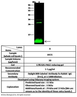 Invitrogen S100A2 Polyclonal Antibody 100 &mu;L | Buy Online | Invitrogen&trade; | Fisher Scientific