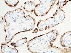 Invitrogen S100P Polyclonal Antibody 100 &mu;L | Buy Online | Invitrogen&trade; | Fisher Scientific