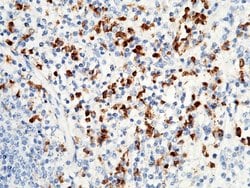 Invitrogen S100P Polyclonal Antibody 100 &mu;L | Buy Online | Invitrogen&trade; | Fisher Scientific