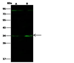 Invitrogen CD138 Polyclonal Antibody 100 &mu;L; Unconjugated:Antibodies,