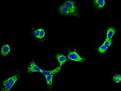 Invitrogen SEMA6A Polyclonal Antibody 100 &mu;L; Unconjugated:Antibodies,