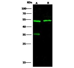 Invitrogen Neuroserpin Polyclonal Antibody 100 &mu;L; Unconjugated:Antibodies,