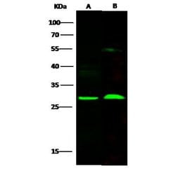 Invitrogen SNAP25 Polyclonal Antibody 100 &mu;L; Unconjugated:Antibodies,