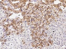 Invitrogen SOCS4 Polyclonal Antibody 100 &mu;L; Unconjugated:Antibodies,