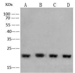 SOD1 Polyclonal Antibody, Invitrogen 100 &mu;L; Unconjugated:Antibodies,