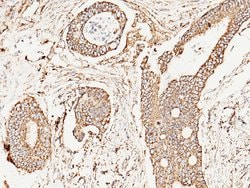 Invitrogen SOD2 Polyclonal Antibody 100 &mu;L; Unconjugated:Antibodies,