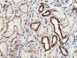Invitrogen SOD2 Polyclonal Antibody 100 &mu;L; Unconjugated:Antibodies,